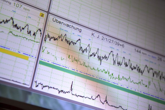 Abbildung eines Überwachungs-EKG.
