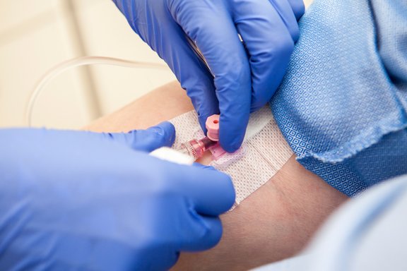 Hände mit blauen Latexhandschuhen legen einen Zugang am Arm für die Infusionstherapie.